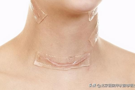 中医养生与甲状腺结节手术：微创手术和开刀手术的优劣
