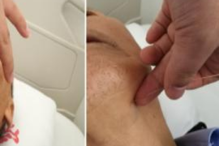 中医养生视角：剖析年轻人中风的原因和预防