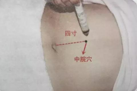 想通过拔罐减肥？一个疗程大概能瘦几斤？
