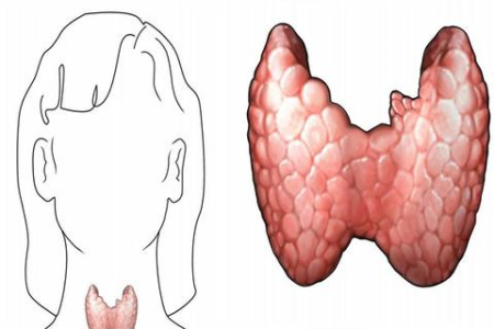 中医养生视角：甲状腺结节尺寸与手术的关系