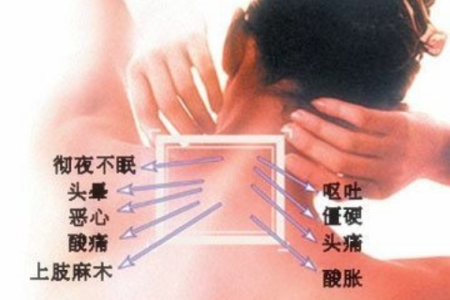 中医养生颈椎病怎么治疗最好最有效？试试这些方法！