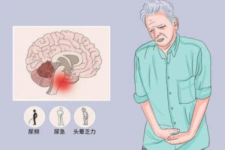 中医养生与共济失调：是什么原因导致这种疾病？