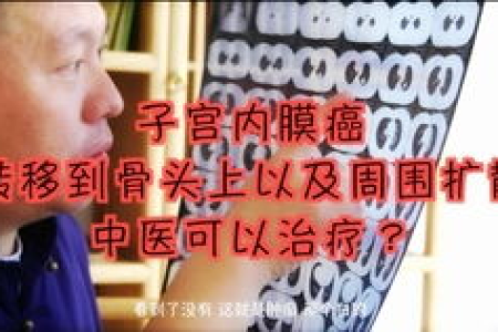七十岁老人更年期症状？中医养生调理方法