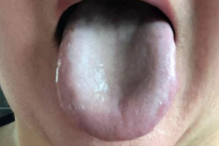 中医养生瘦身：肥胖者减肥的正确打开方式