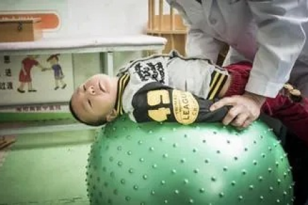如何识别脑瘫早期症状？中医养生调理方法