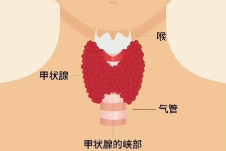 2-3级甲状腺结节严重吗？中医养生如何调理？