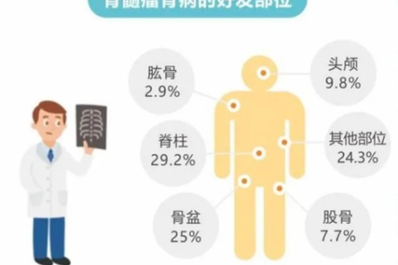 骨髓瘤患者寿命：几种类型骨髓瘤生存期及养生饮食建议