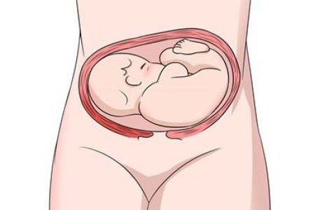 怀孕晚期枕横位、枕后位怎么办？能顺产吗？