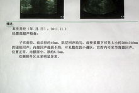 女性生殖系统肿瘤知多少？孕前检查不容忽视