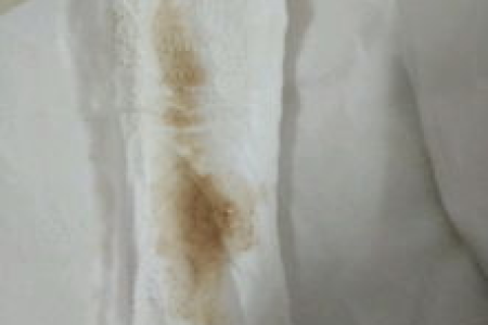 想要宝宝：排卵期褐色分泌物影响怀孕吗？
