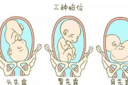 担心胎位不正？孕期睡姿真的会影响胎儿吗？