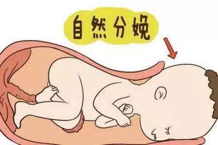 顺产剖腹产哪个好？产后恢复期利弊深度对比，助你明智选择！