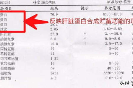 孕前检查肝功能报告单怎么看？快速掌握解读技巧
