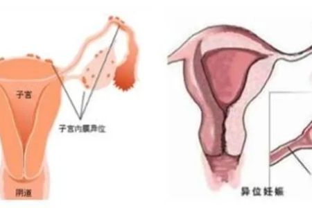 孕前检查知多少？详解人体生殖系统结构功能
