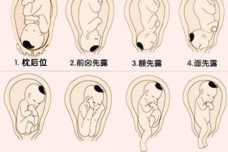 怀孕期间胎位不正的原因是什么？全面解读胎位不正的成因及应对