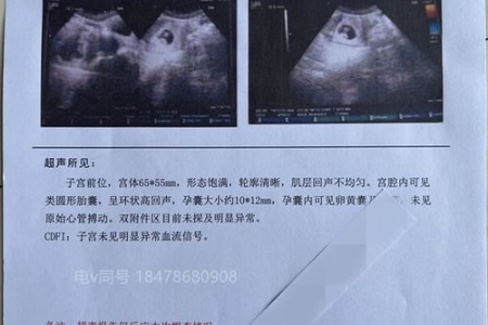 普通血常规检查对孕前准备的重要性及能发现的疾病