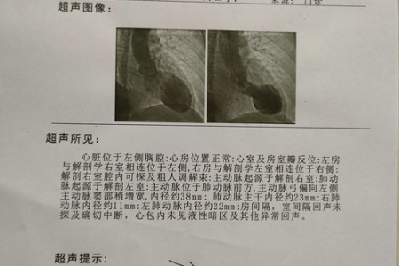 孕前准备血常规检查项目有哪些？多少钱？