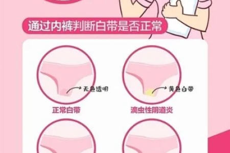 孕前准备：排卵期出现褐色白带，是疾病还是正常？