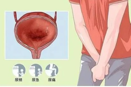 孕前准备男性尿道刺痛腰酸痛小腹痛怎么办？