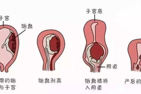 产后恶露期间能喝红糖水吗？红糖水对恶露排出的影响