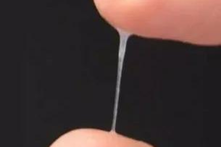孕前准备：排卵期水样白带不拉丝正常吗？