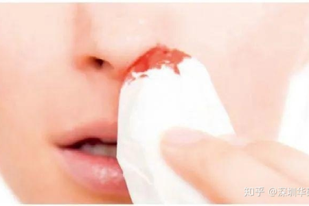 秋天鼻出血反复发作？试试这些食物调理