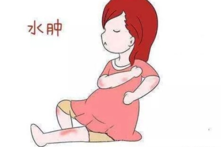 孕早期浮肿是什么原因？如何预防和缓解？