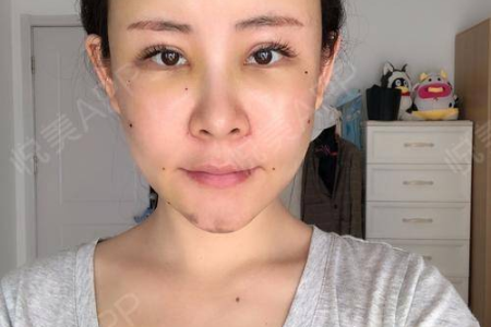 脸部浮肿超级丑的原因 原来是这3个习惯惹的祸