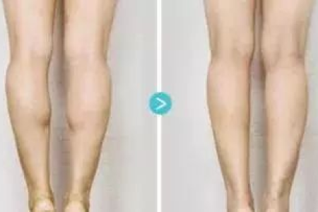 不吃药也能快速减肥的方法是什么 不节食不运动小妙招
